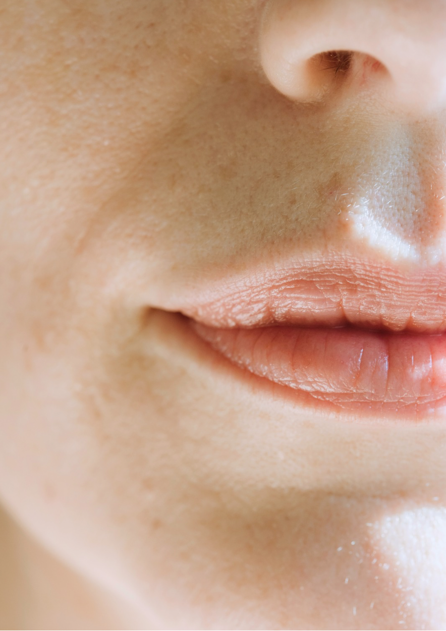 Pourquoi les pores se dilatent-ils ?