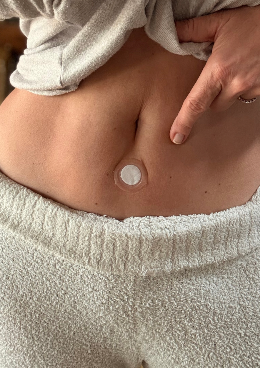 Patch de photothérapie LifeWave placé sous le nombril sur le point CV6, utilisé pour soutenir l’énergie vitale et l’équilibre du corps.